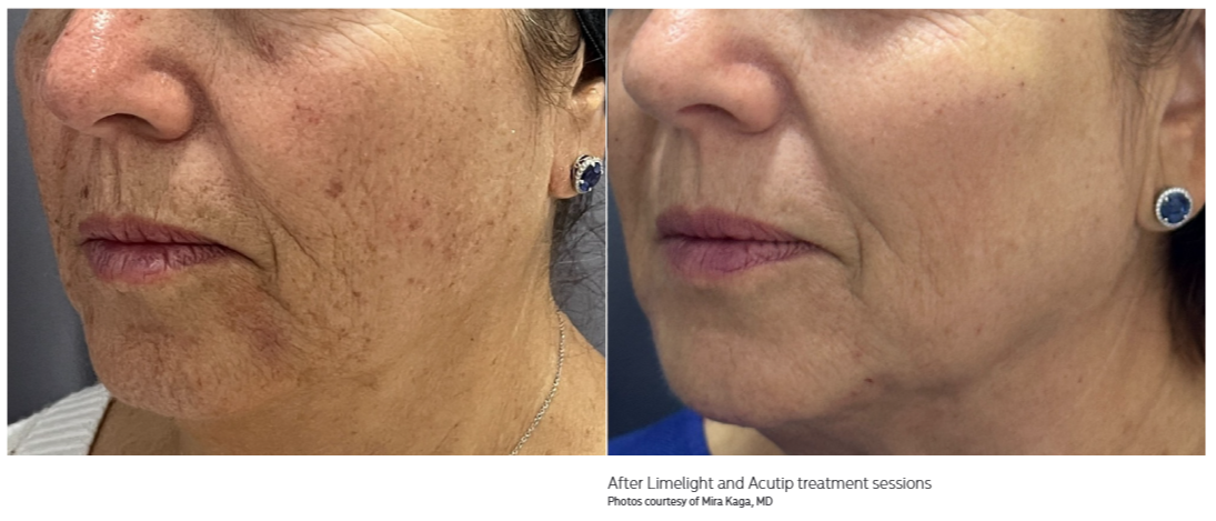 truBody Results Miami