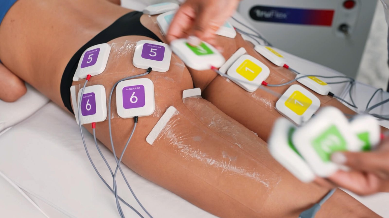 truBody Results Miami